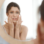 How does stress affect the skin and how to manage it